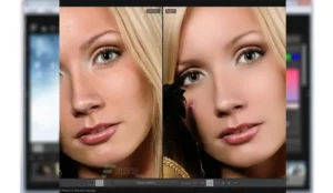 SkinFiner 2